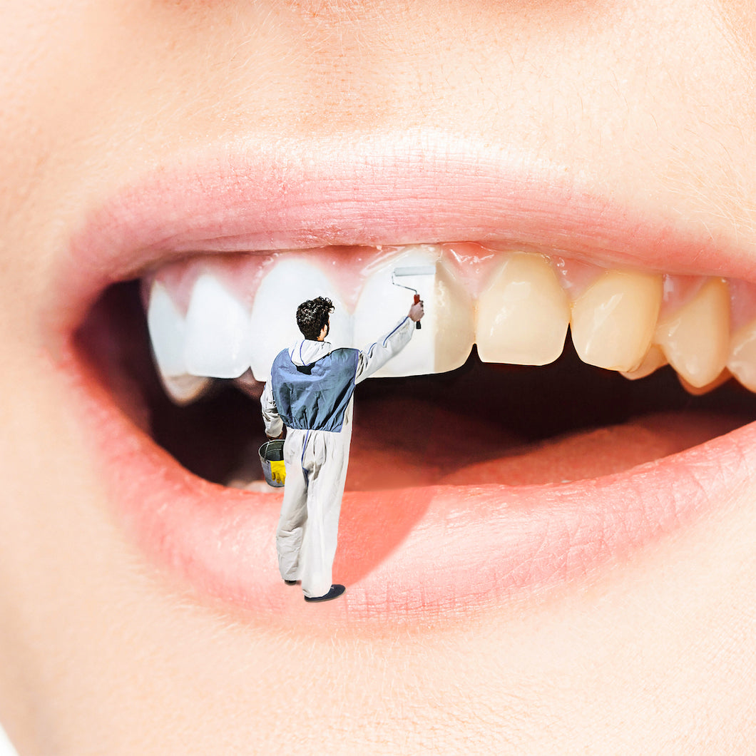 Blanchiment Dentaire à Rabat