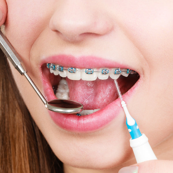 Orthodontie pour enfants et adolescents au cabinet dentaire du Dr Meryam Mamouni à Rabat