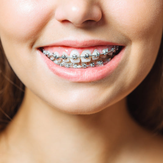 Orthodontie pour enfants au cabinet dentaire du Dr Meryam Mamouni à Rabat