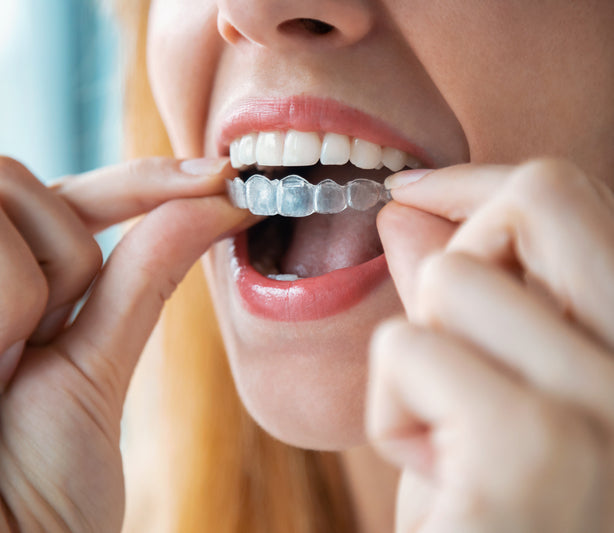 Traitement Orthodontique Invsisalign réalisé au cabinet dentaire du Dr Meryam Mamouni à Rabat