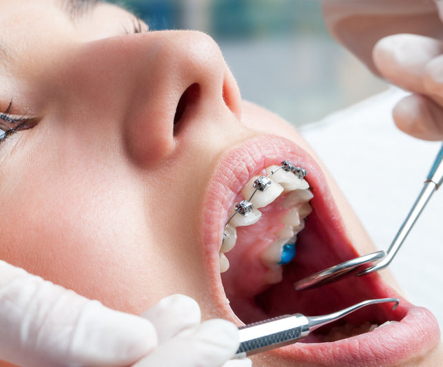 Traitement orthodontique pour adultes réalisé au cabinet dentaire du Dr Meryam Mamouni à Rabat